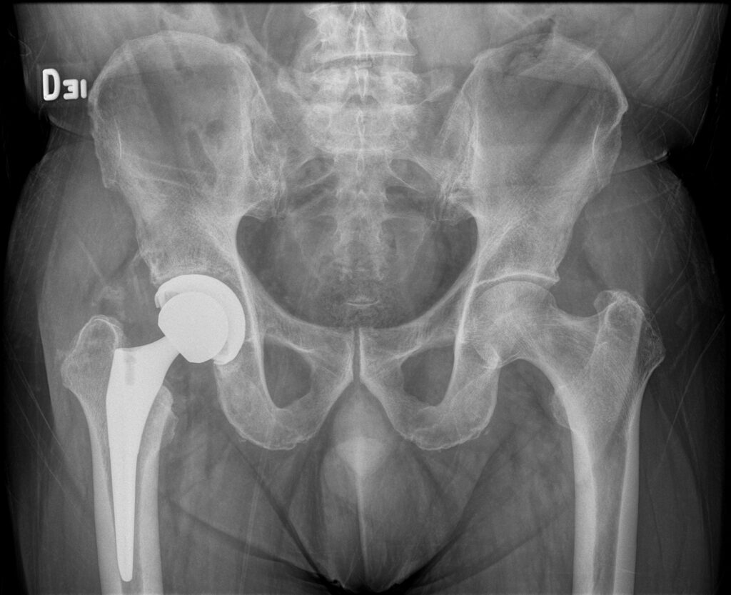 Home pop rtc derecha